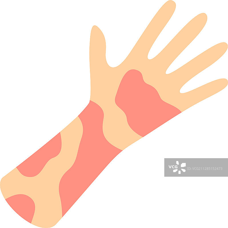 接触性皮炎扁平设计长阴影彩色图标图片素材