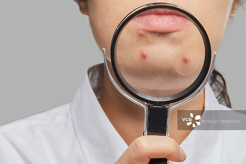 人体皮肤，皮肤病学，美容，痤疮图片素材