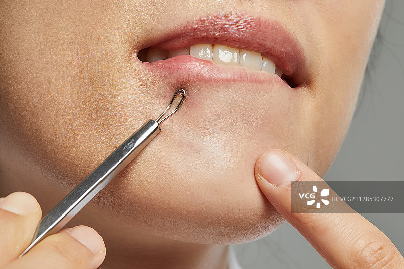 人体皮肤，皮肤病学，美容，痤疮图片素材