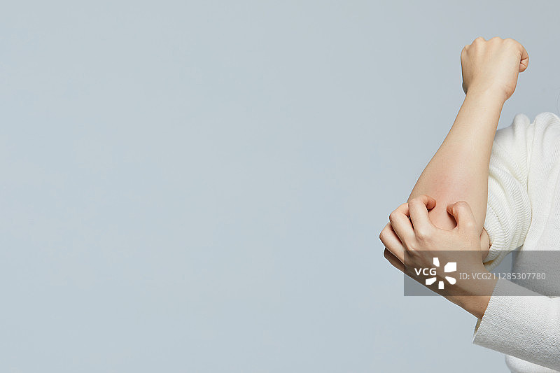 特应性皮炎，皮炎，皮肤问题，皮肤瘙痒，皮肤科图片素材