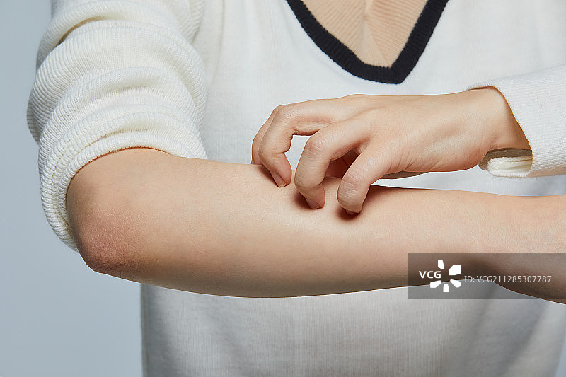 特应性皮炎，皮炎，皮肤问题，皮肤瘙痒，皮肤科图片素材