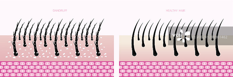 头发保护和护理技术图片素材