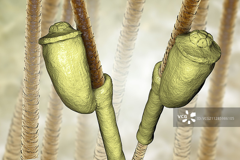 头虱卵插画图片素材