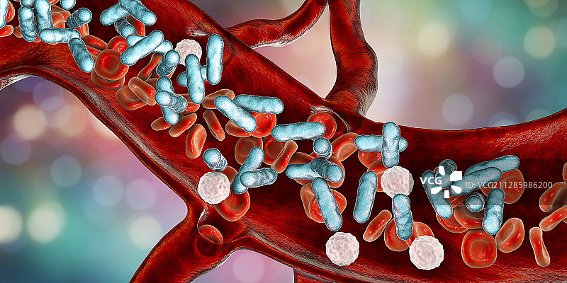 细菌性血感染插图图片素材