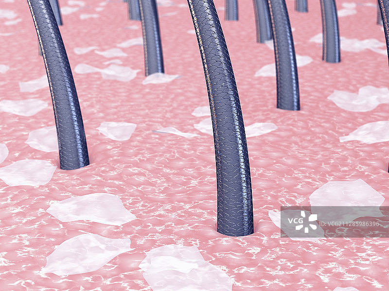 头皮屑插图图片素材