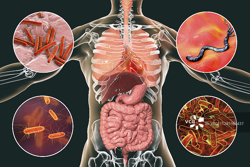 引起人类感染的细菌，图示图片素材
