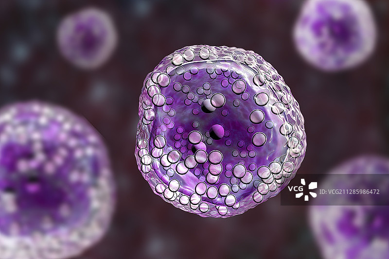伯基特淋巴瘤细胞图图片素材