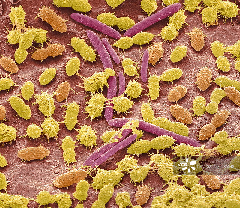 粪便细菌扫描电镜图图片素材