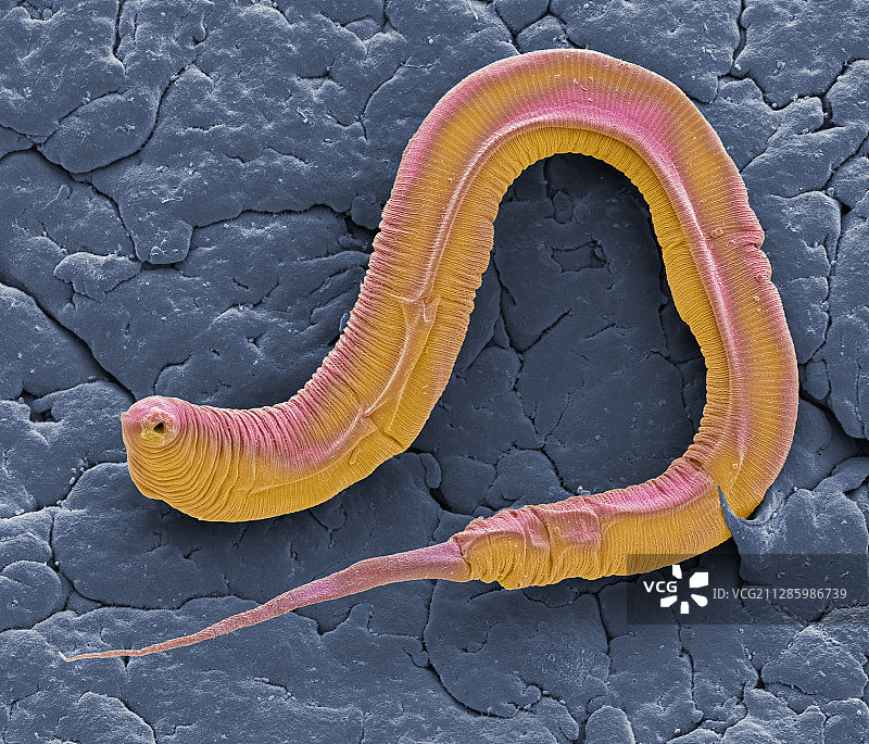 秀丽隐杆线虫，扫描电镜图片素材