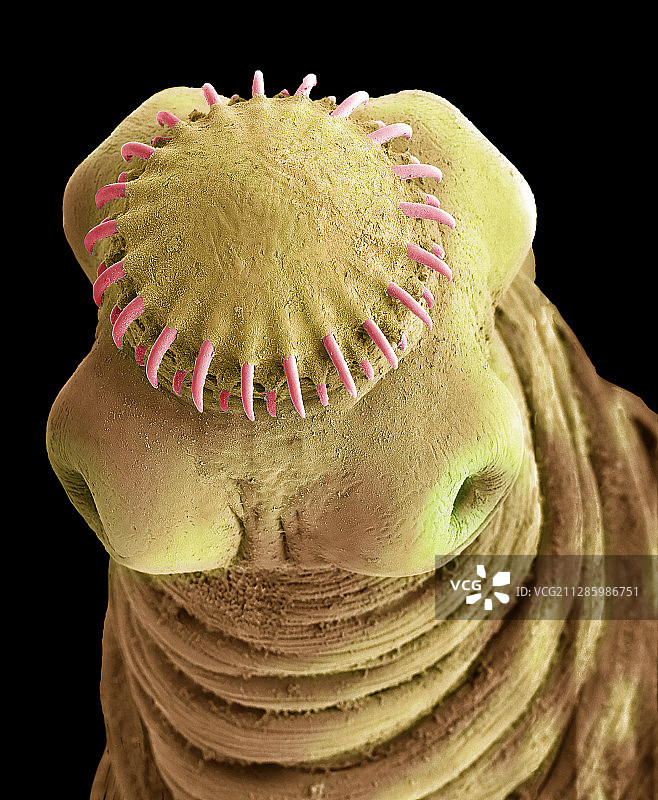 绦虫囊尾蚴扫描电镜图图片素材