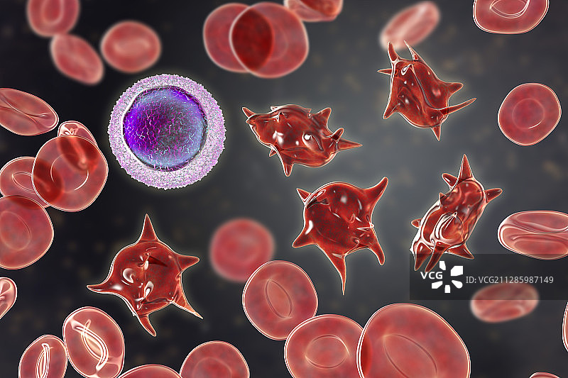 棘细胞异常红细胞，图示图片素材