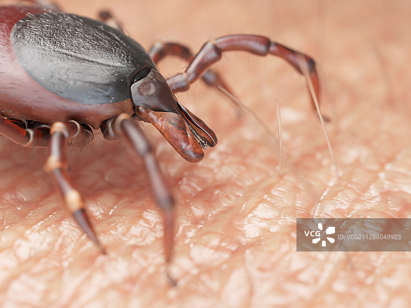 在人体皮肤上爬行的蜱虫插画图片素材