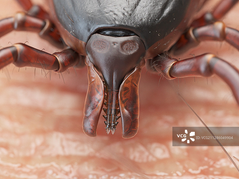 在人体皮肤上爬行的蜱虫插画图片素材