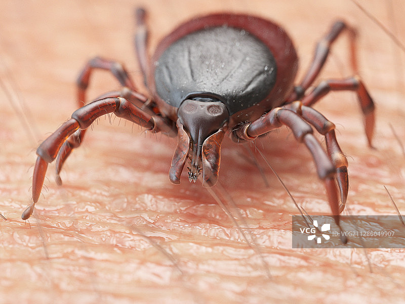 在人体皮肤上爬行的蜱虫插画图片素材