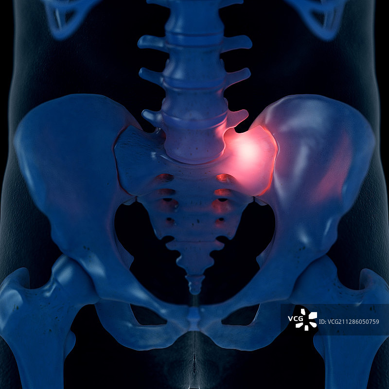 疼痛的骶骨关节插画图片素材