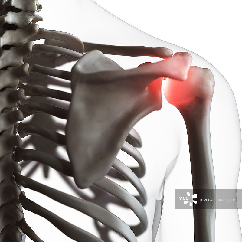 肩关节疼痛插画图片素材
