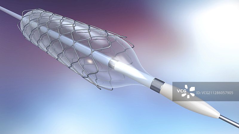 支架和球囊导管插图图片素材