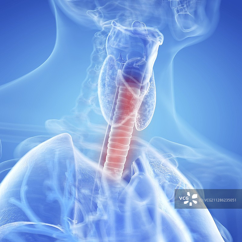 发炎的气管插画图片素材