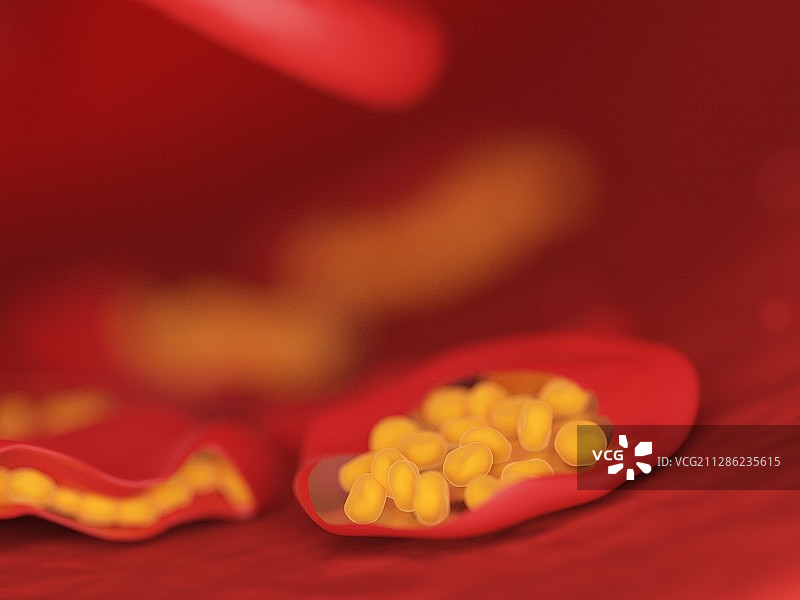 疟疾感染血细胞插画图片素材