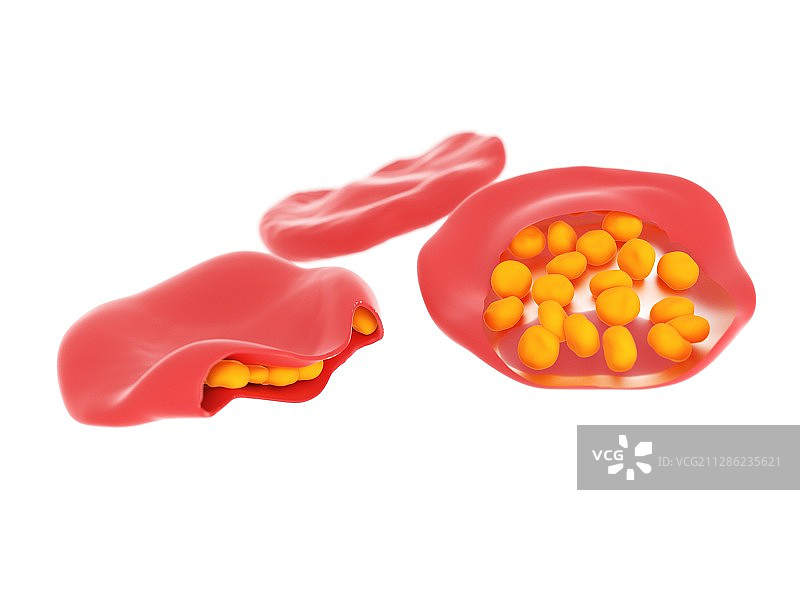 疟疾感染血细胞插画图片素材