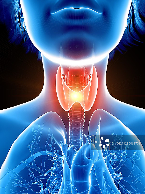 嗓子不舒服的女人插画图片素材