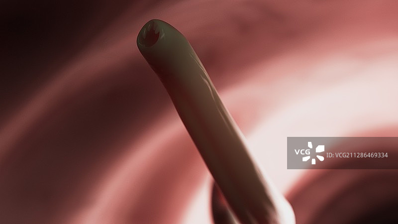 钩虫插画图片素材