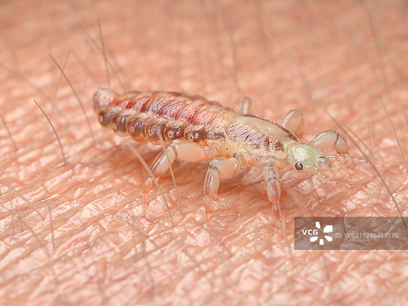 头虱插画图片素材