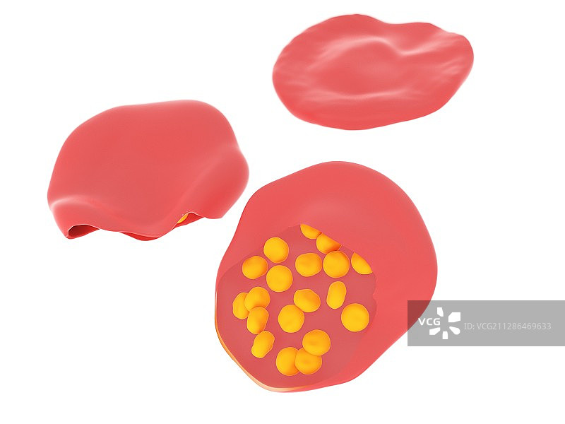 疟疾感染血细胞插画图片素材