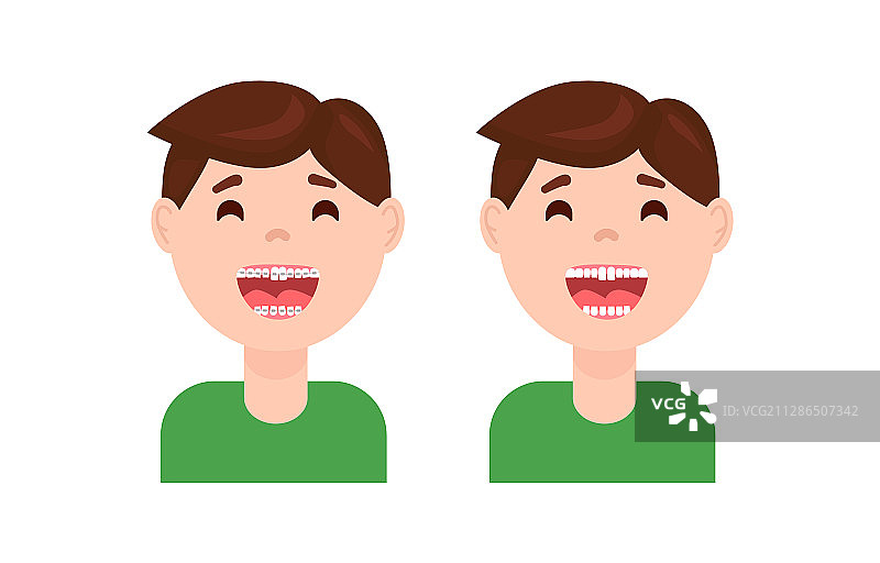 牙齿矫正治疗前后对比图片素材