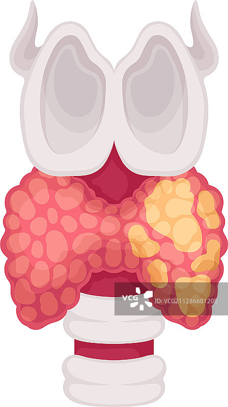 白色背景上的人体甲状腺器官图片素材