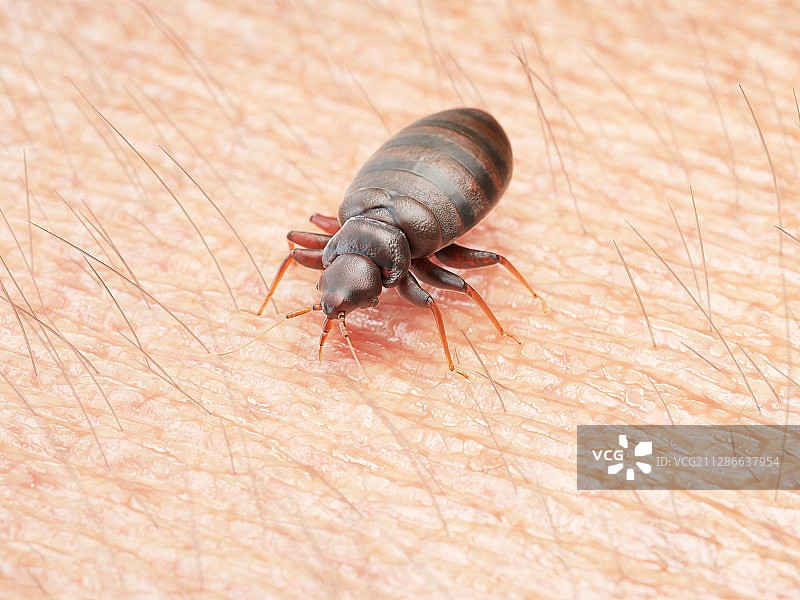 人体皮肤上的臭虫插画图片素材