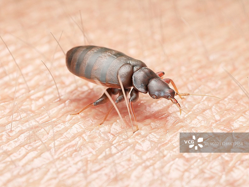 人体皮肤上的臭虫插画图片素材