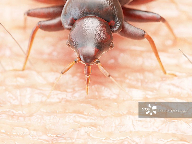 人体皮肤上的臭虫插画图片素材