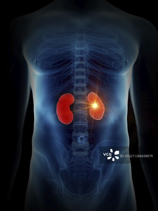 疼痛的肾脏插画图片素材