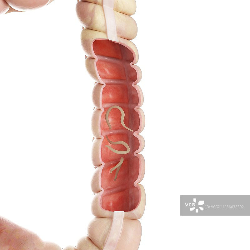 大肠内钩虫插画图片素材