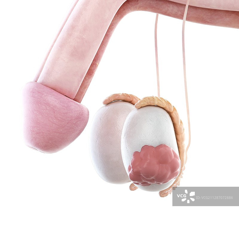 睾丸癌插画图片素材