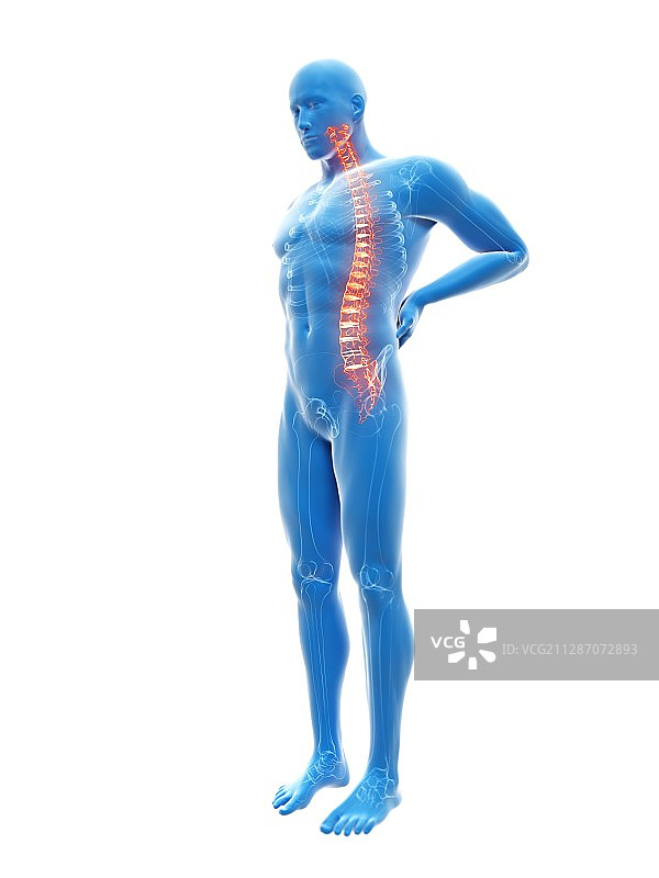 背痛的男人插画图片素材