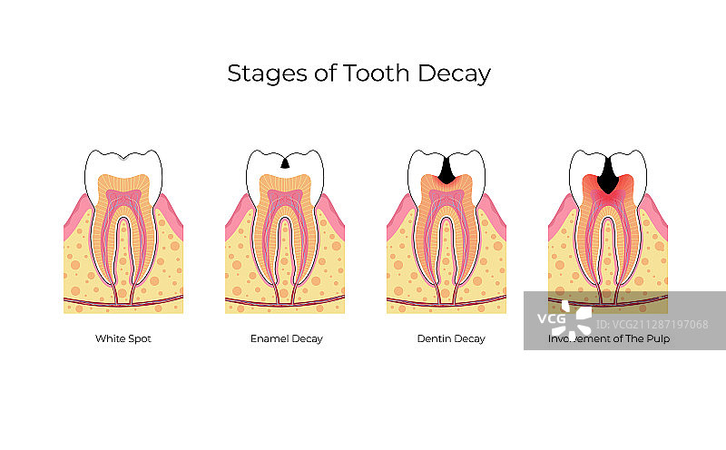 独立牙齿图片素材