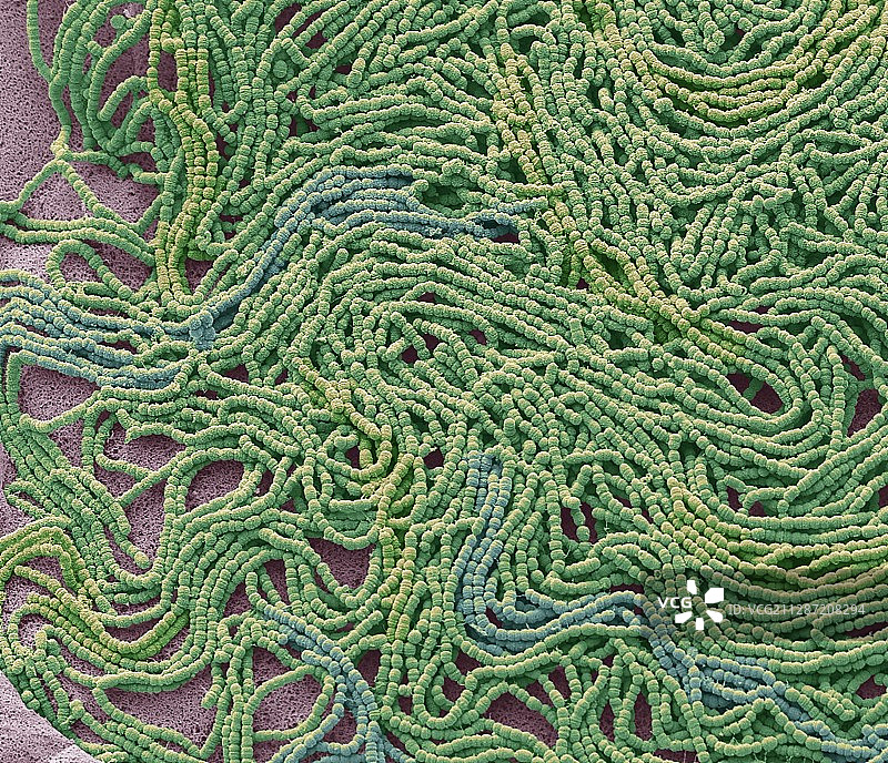 痰培养，扫描电子显微镜图片素材