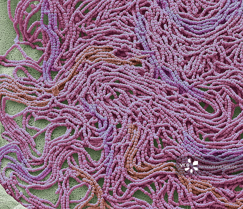 痰培养，扫描电子显微镜图片素材