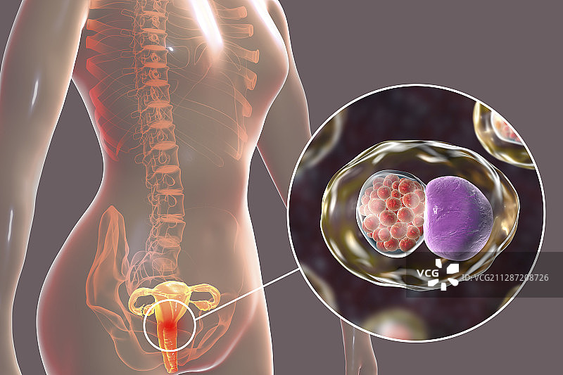 衣原体感染插图图片素材