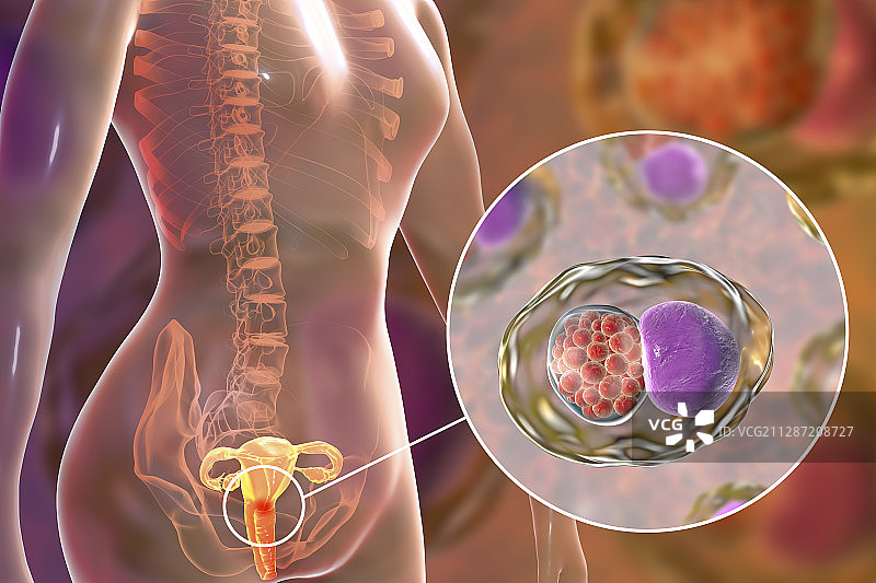 衣原体感染插图图片素材