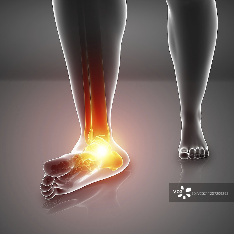 脚痛的男人插画图片素材