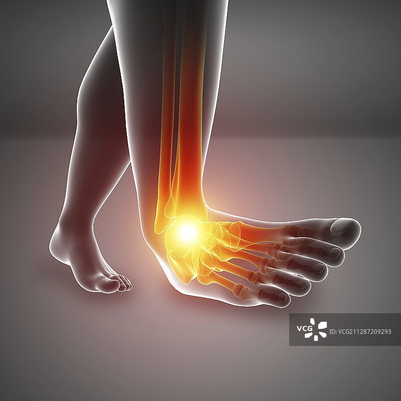 脚痛的男人插画图片素材