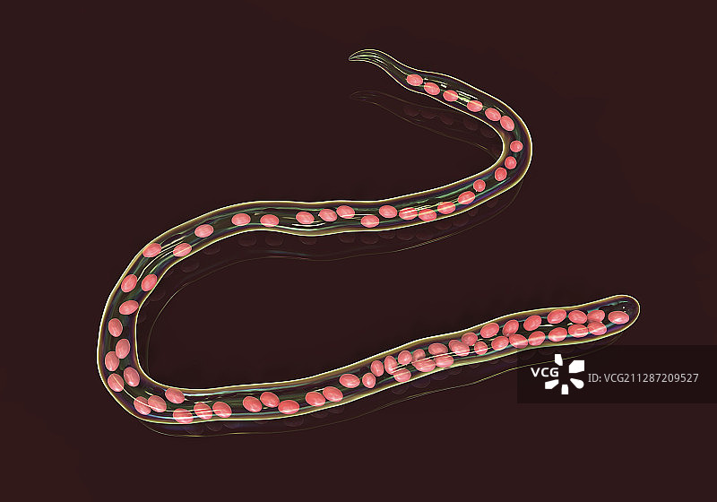 奥氏曼森线虫寄生虫插图图片素材