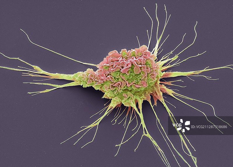 树突状细胞扫描电镜图图片素材