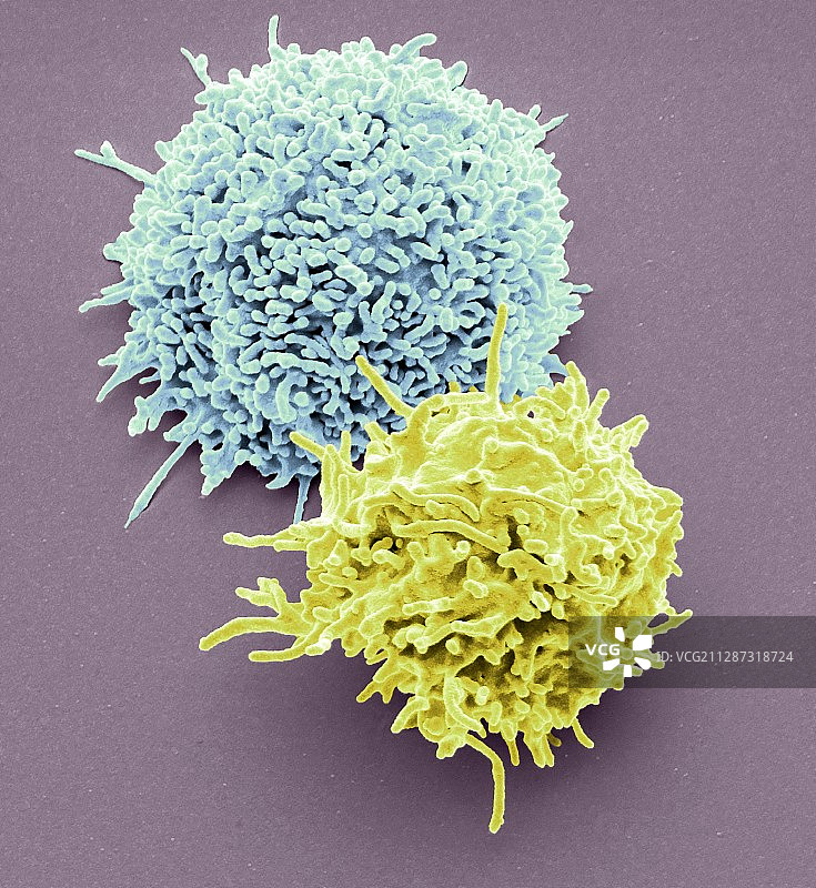 T淋巴细胞扫描电镜图图片素材