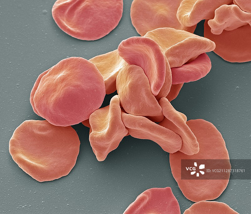 红细胞扫描电子显微镜图像图片素材