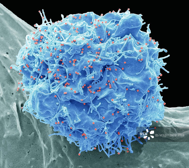 艾滋病毒感染细胞，扫描电镜图片素材