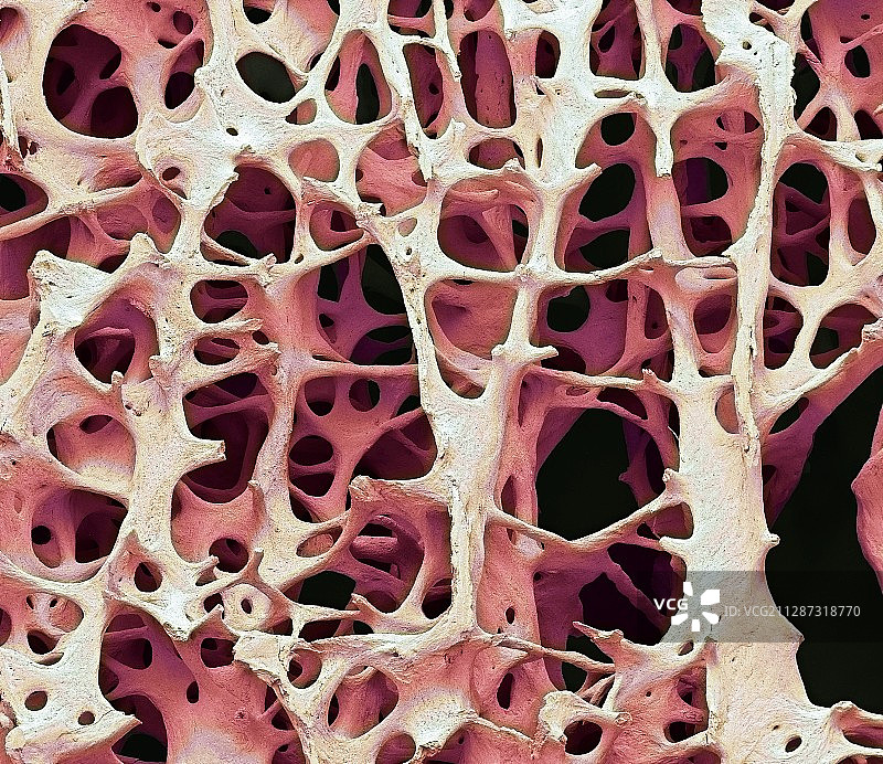 骨组织扫描电镜图图片素材